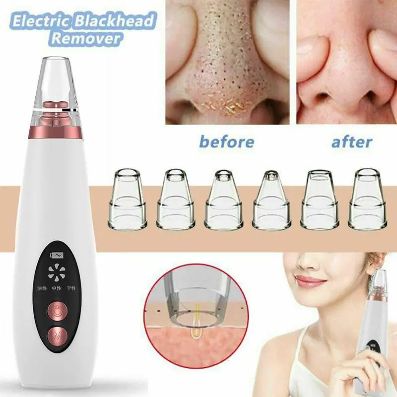 Vacuum Cleaner Blackhead Remover Black Dot Machine Skin Pore Suction Extractor Nose Cleansing Face Acne Black Head Clean Point